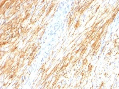Anti-GFAP(ASTRO/789), CF640R conjugate - image 1