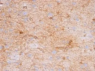 Anti-GFAP(GA-5), CF770 conjugate - image 3