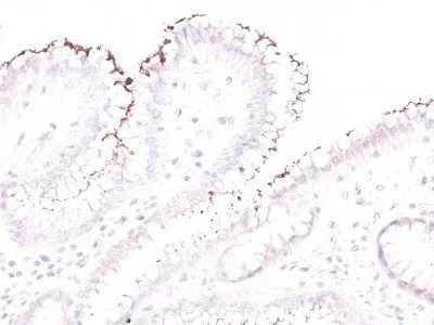 Anti-Helicobacter pylori(Rabbit PAb) - image 1