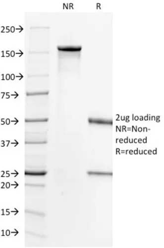 Anti-HER-2 / CD340(HRB2/718), Biotin conjugate - image 1