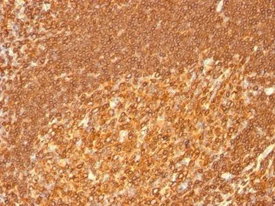 Anti-HLA-DRB(HLA-DRB/1067) - image 3