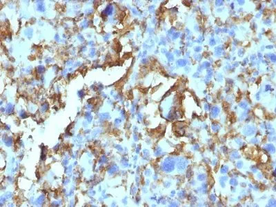 Anti-HLA-DRB(LN-3 + HLA-DRB/1067) - image 2