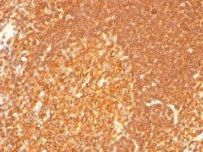 Anti-HLA-DRB(LN-3 + HLA-DRB/1067), CF568 conjugate - image 1