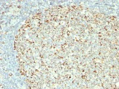 Anti-HSP60(GROEL/730) - image 2