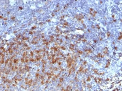 Anti-Human IgG Immunoglobulin(IG266) - image 1