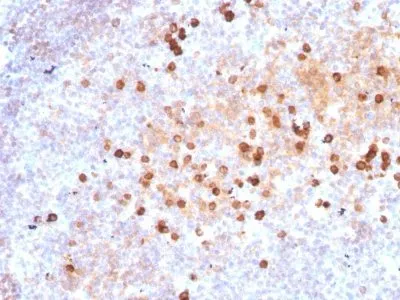 Anti-Human IgM Immunoglobulin(IM373) - image 2
