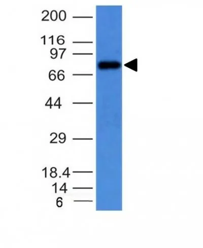Anti-Human IgM Immunoglobulin(IM373) - image 1