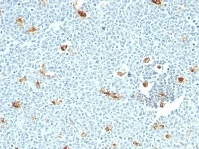Anti-Macrophage Specific Antigen(LN-5) - image 1