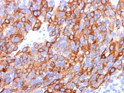 Anti-MART-1 / Melan-A(M2-7C10 + M2-9E3 + A103), CF640R conjugate - image 1