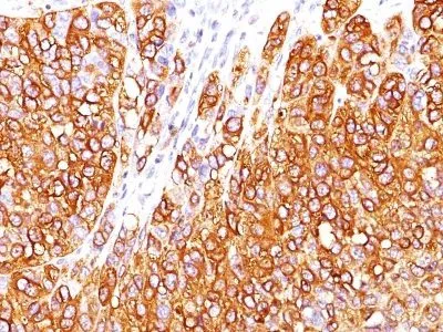 Anti-MART-1 / Melan-A(M2-7C10) - image 2