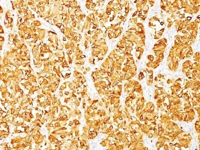 Anti-MART-1 / Melan-A(M2-7C10), CF640R conjugate - image 1