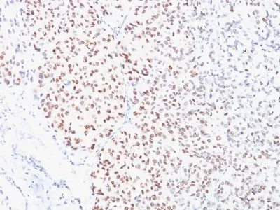 Anti-MiTF (Microphthalmia Transcription Factor)(C5/D5) - image 1