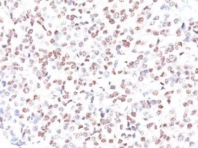 Anti-MiTF (Microphthalmia Transcription Factor)(MITF/915), Biotin conjugate - image 1