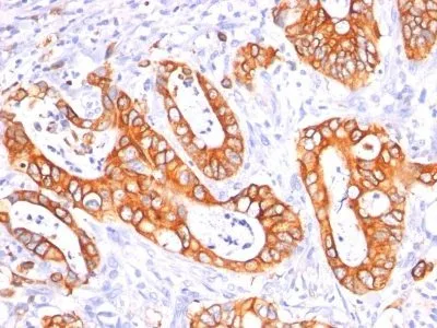 Anti-Mucin 1 / EMA / Episialin / CD227(GP1.4 + E29) - image 1
