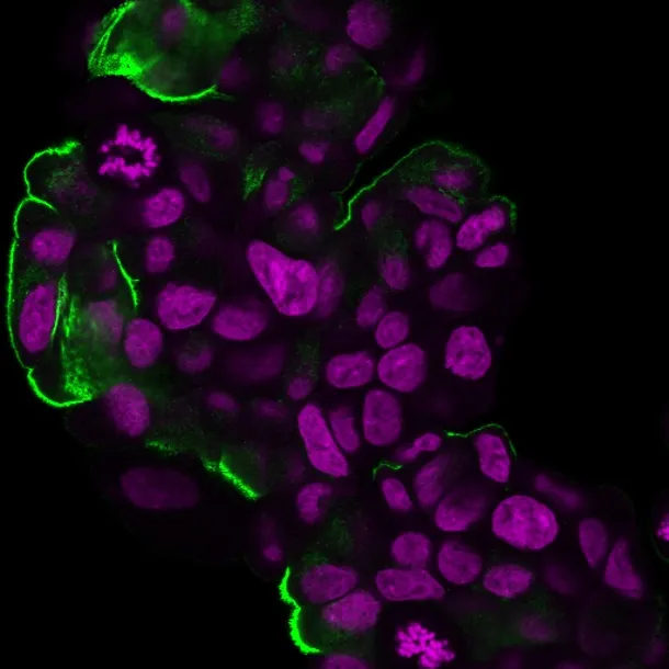 Anti-Mucin 1 / EMA / Episialin / CD227(HMPV), CF594 conjugate - image 1