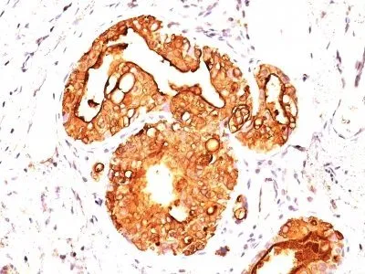 Anti-Mucin 1 / EMA / Episialin / CD227(MUC1/955), Biotin conjugate - image 2