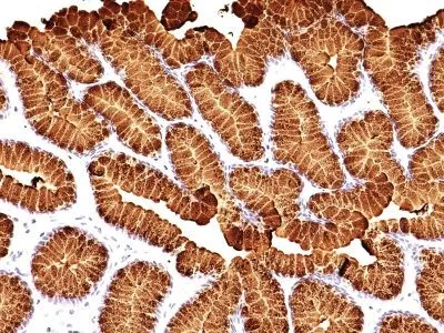 Anti-Mucin 5AC (MUC5AC)(MUC5AC/917 + 45M1), CF647 conjugate - image 1