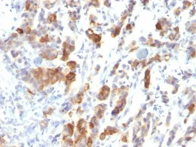 Anti-Mucin 5AC (MUC5AC)(MUC5AC/917) - image 1