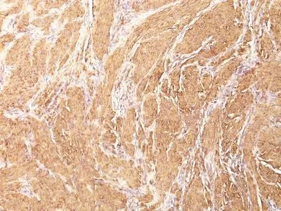 Anti-Muscle Specific Actin(HHF35) - image 1