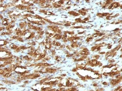 Anti-Muscle Specific Actin(HHF35) - image 2