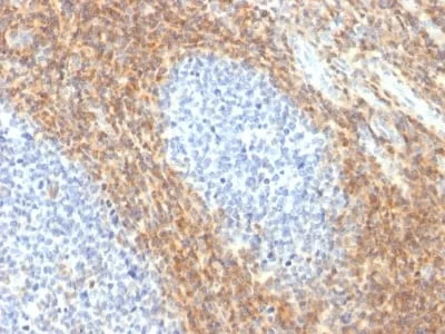 Anti-CD52 (Epididymis-Specific Protein 5) (CD52/2276R), CF740 conjugate - image 1