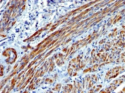 Anti-Myosin, Smooth Muscle Heavy Chain(MYH11/923) - image 2