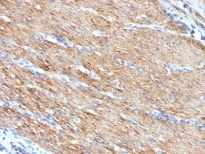 Anti-Myosin, Smooth Muscle Heavy Chain(MYH11/923) - image 3