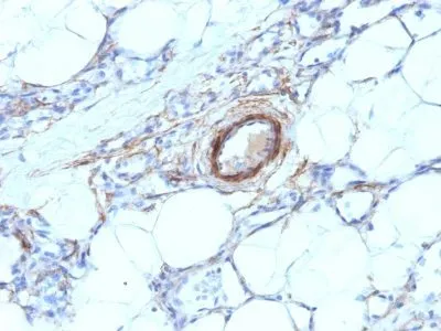 Anti-Myosin, Smooth Muscle Heavy Chain(MYH11/923) - image 4