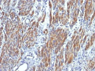 Anti-Myosin, Smooth Muscle Heavy Chain(SMMS-1) - image 2