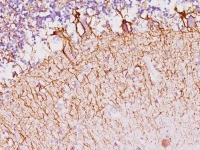Anti-Neurofilament (NF-H)(NF421) - image 1