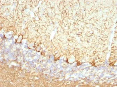 Anti-Neurofilament (NF-L)(NFL/736) - image 1