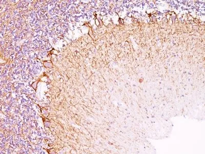Anti-Neurofilament (NF-L)(NR-4) - image 1