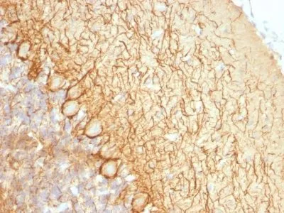Anti-Neurofilament (NF-L)(NR-4) - image 2