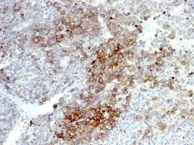 Anti-NGFR (Nerve Growth Factor Receptor)(NGFR5 + NTR/912), CF594 conjugate - image 2