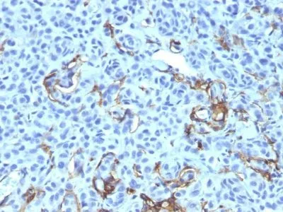 Anti-NGFR (Nerve Growth Factor Receptor)(NGFR5 + NTR/912), CF594 conjugate - image 1