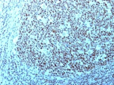 Anti-Nucleolin(364-5 + NCL/902), CF640R conjugate - image 7