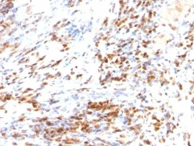 Anti-p27 / KIP1(DCS-72.F6 + KIP1/769 (SX53G8)), CF640R conjugate - image 1