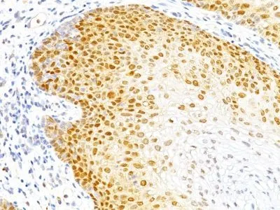 Anti-p27 / KIP1(DCS-72.F6), CF640R conjugate - image 1
