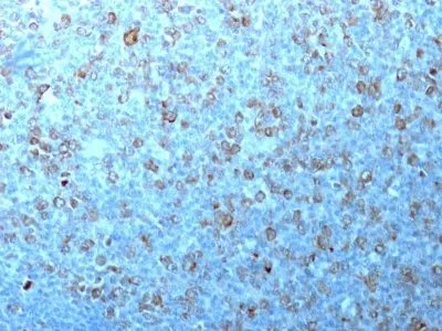 Anti-p34 / cdk1(CDK1/873) - image 1