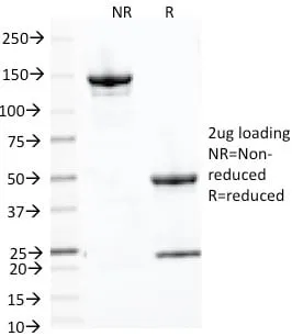 Anti-PLAP (Placental Alkaline Phosphatase)(ALP/870), Biotin conjugate - image 2