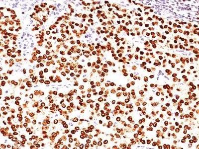 Anti-PLGF(PLGF93), CF640R conjugate - image 1