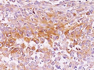 Anti-Pmel17 / gp100 / SILV(NKI-beteb), CF488A conjugate - image 1