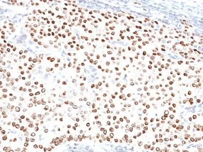 Anti-Progesterone Receptor(PR500) - image 1