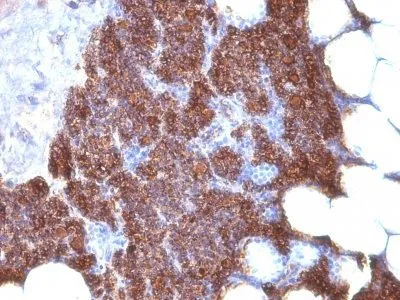 Anti-PTH (Parathyroid Hormone) (N & C Terminal) (3H9 + PTH/1175), CF405S conjugate - image 1