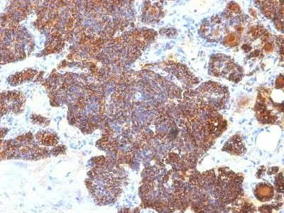 Anti-PTH / Parathyroid Hormone (N-Terminal)(PTH/1173) - image 2