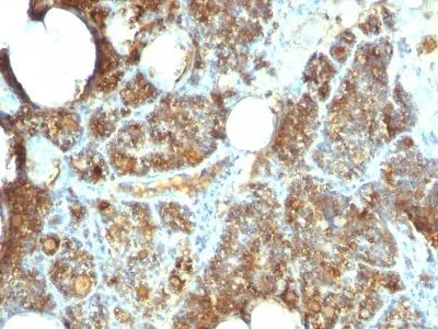 Anti-PTH / Parathyroid Hormone (N-Terminal)(PTH/1173) - image 1