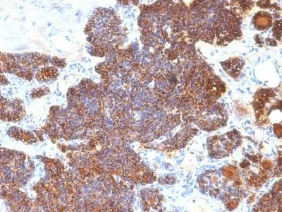 Anti-PTH / Parathyroid Hormone (N-Terminal)(PTH/1174) - image 2