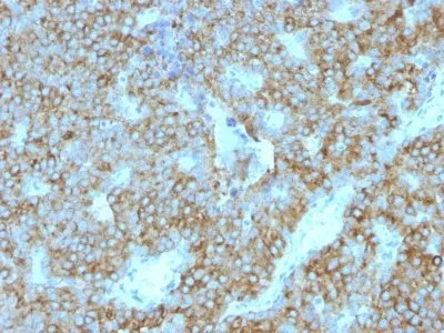 Anti-PTH / Parathyroid Hormone (N-Terminal)(PTH/1175) - image 2