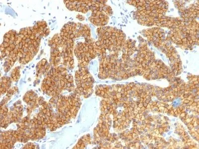 Anti-PTH / Parathyroid Hormone (N-Terminal)(PTH/911) - image 1