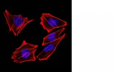 Anti-S100B(4C4.9 + S100B/1012) - image 3